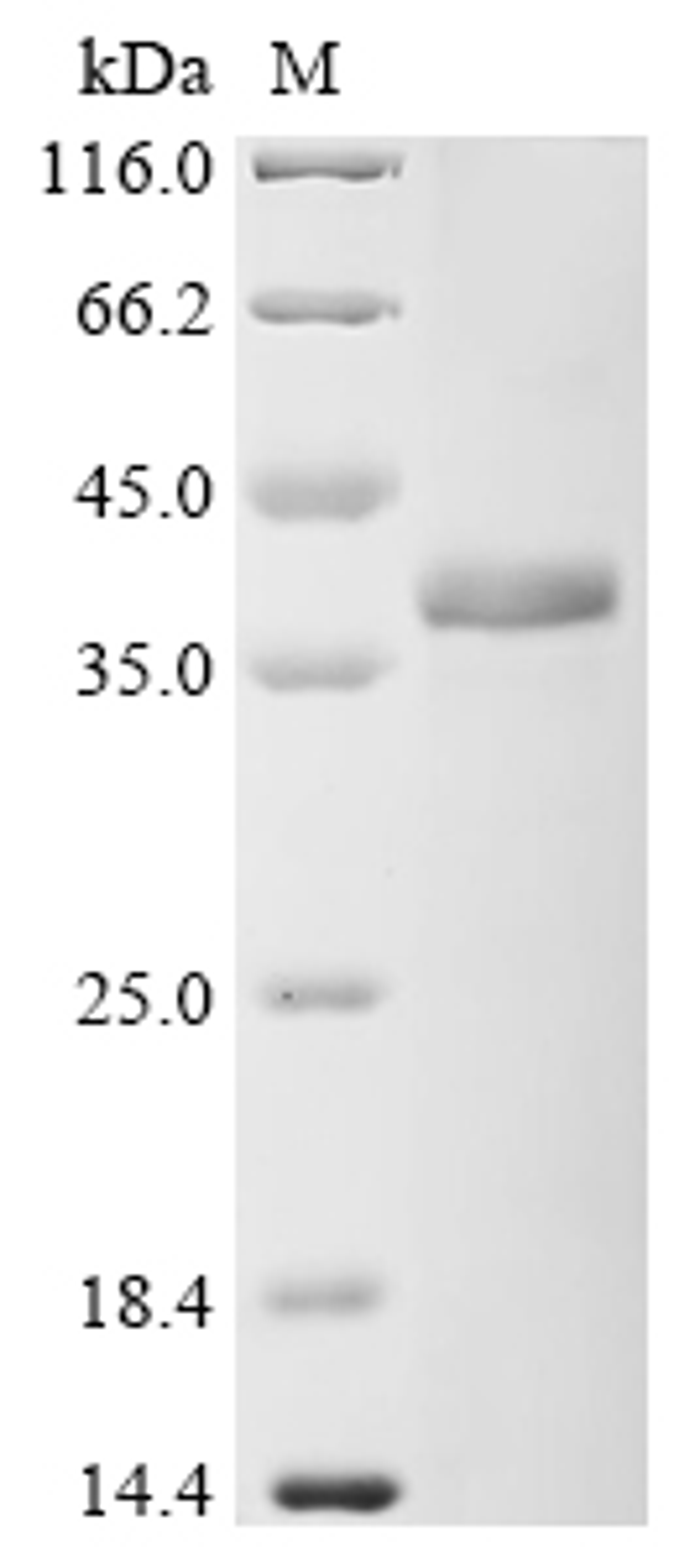 (Tris-Glycine gel) Discontinuous SDS-PAGE (reduced) with 5% enrichment gel and 15% separation gel.