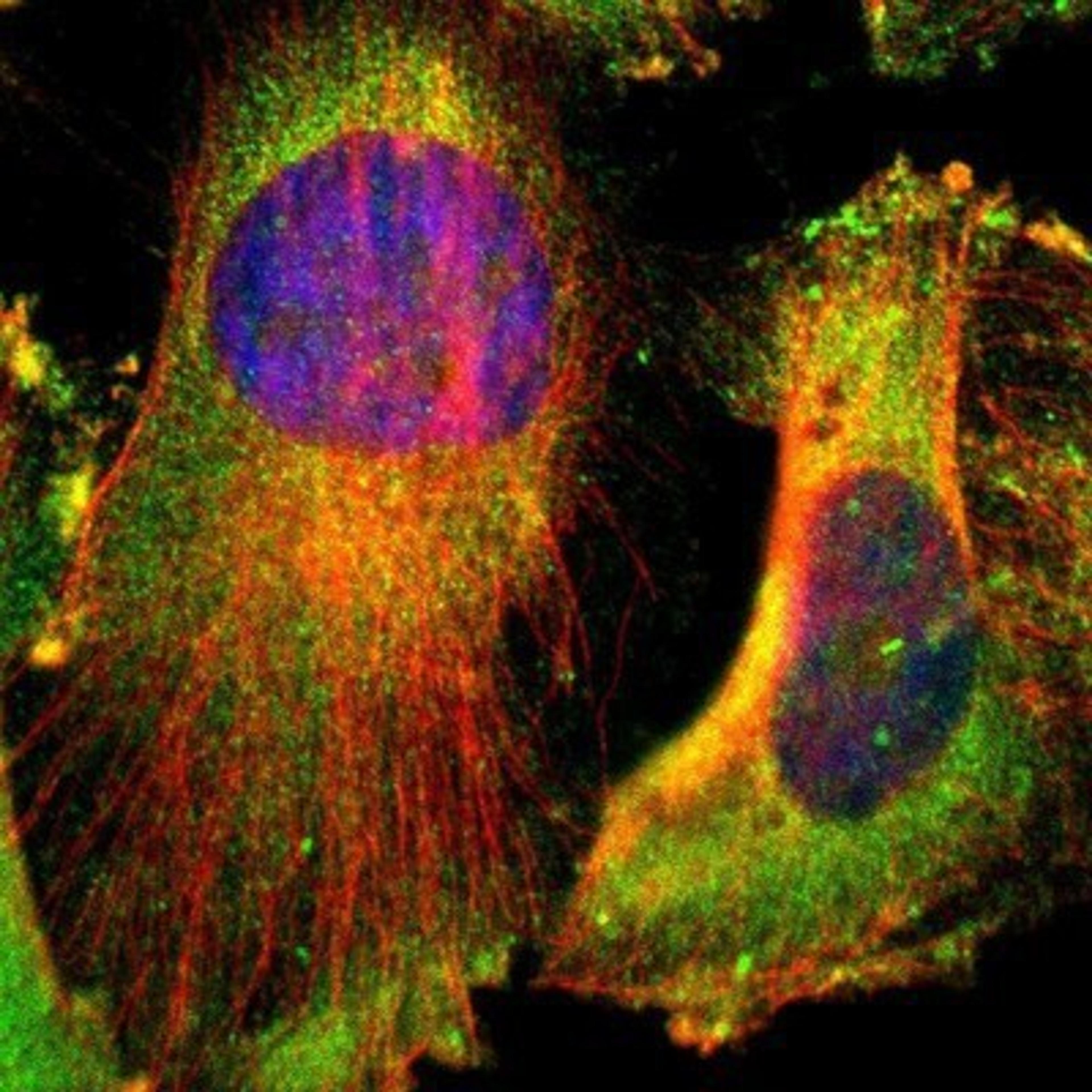 Immunocytochemistry/Immunofluorescence: CD2AP Antibody [NBP1-90625] - Staining of human cell line U-251MG shows positivity in plasma membrane & cytoplasm.