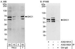 Detection of human DKC1 by western blot and immunoprecipitation.