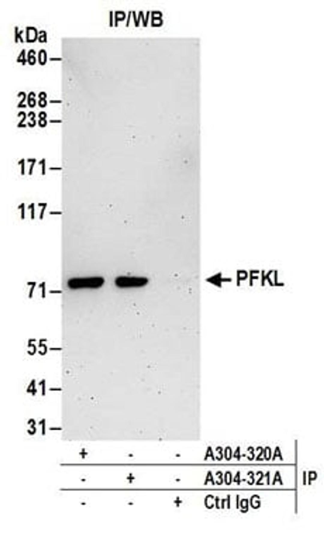 Detection of human PFKL by western blot of immunoprecipitates.