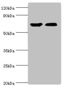 Western blot. All lanes: CROT antibody at 3ug/ml. Lane 1: Mouse kidney tissue. Lane 2: A431 whole cell lysate. Secondary. Goat polyclonal to rabbit IgG at 1/10000 dilution. Predicted band size: 71, 11, 74 kDa. Observed band size: 71 kDa.