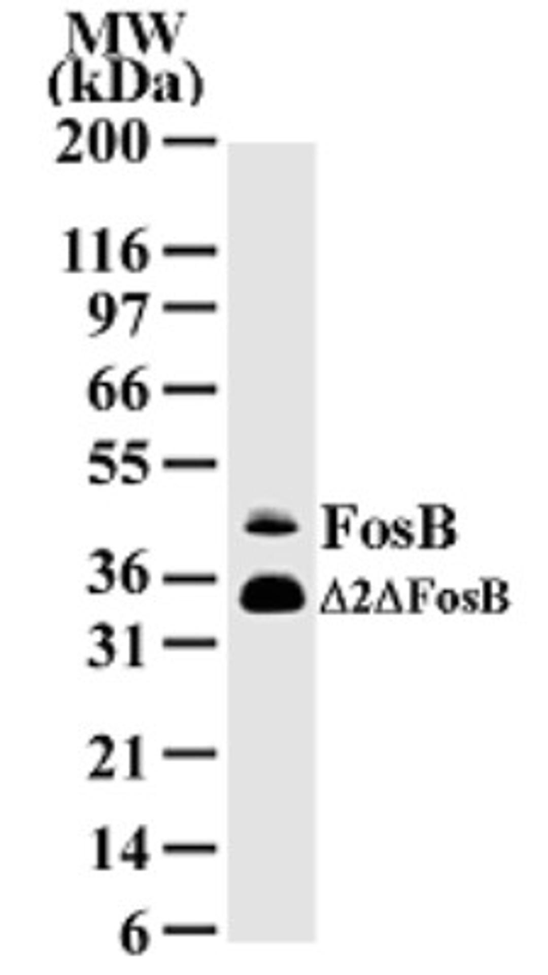 Western Blot: Fos B Antibody (83B1138) [NB100-56530] - analysis of FosB in HeLa cell lysate using this antibody.