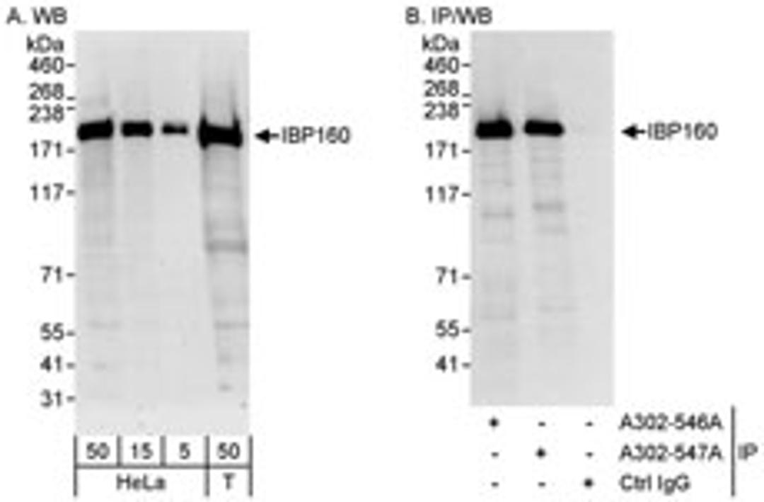 Detection of human IBP160 by western blot and immunoprecipitation.