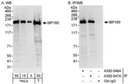 Detection of human IBP160 by western blot and immunoprecipitation.