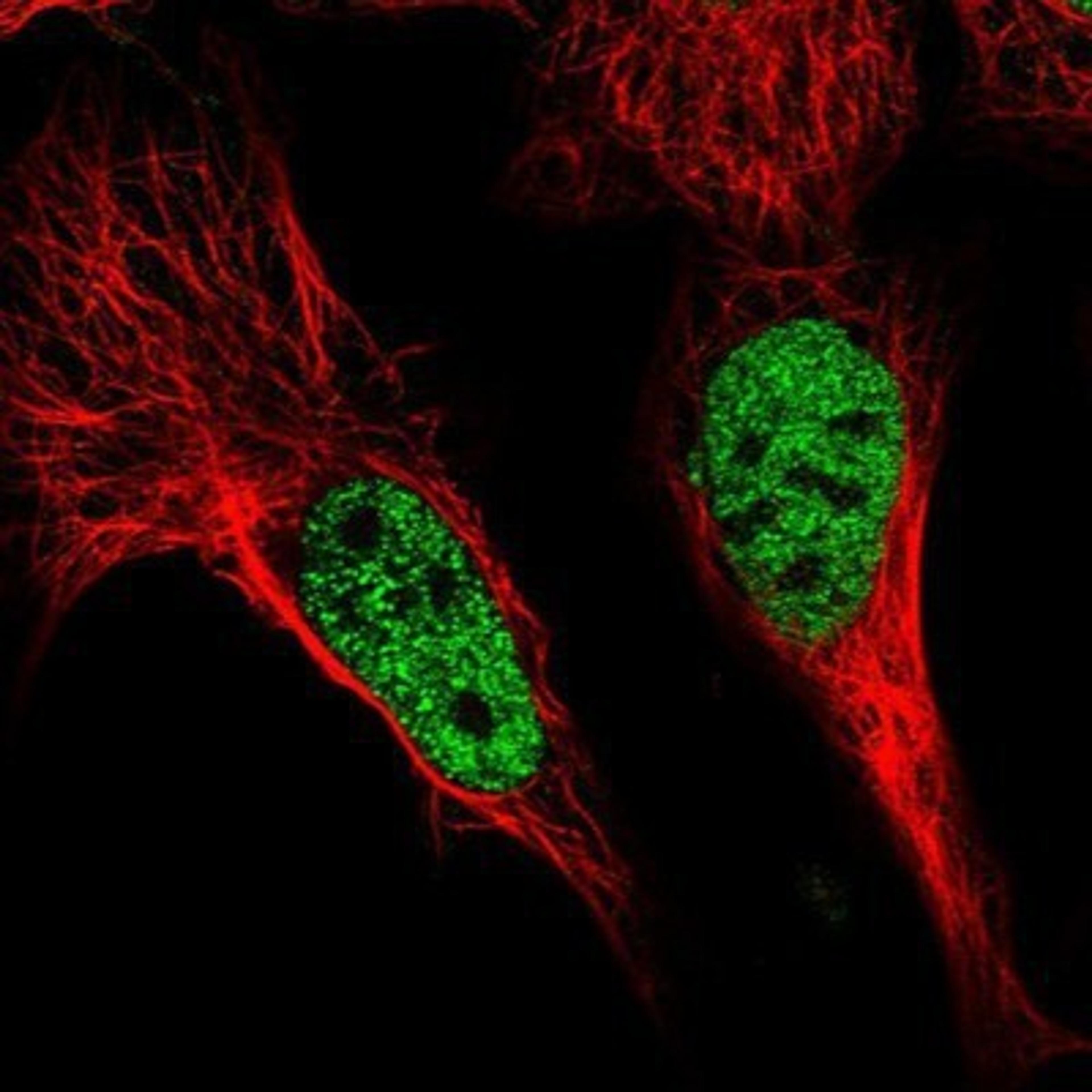 Immunocytochemistry/Immunofluorescence: POU4F3 Antibody [NBP1-88349] - Staining of human cell line U-2 OS shows positivity in nucleus but not nucleoli.