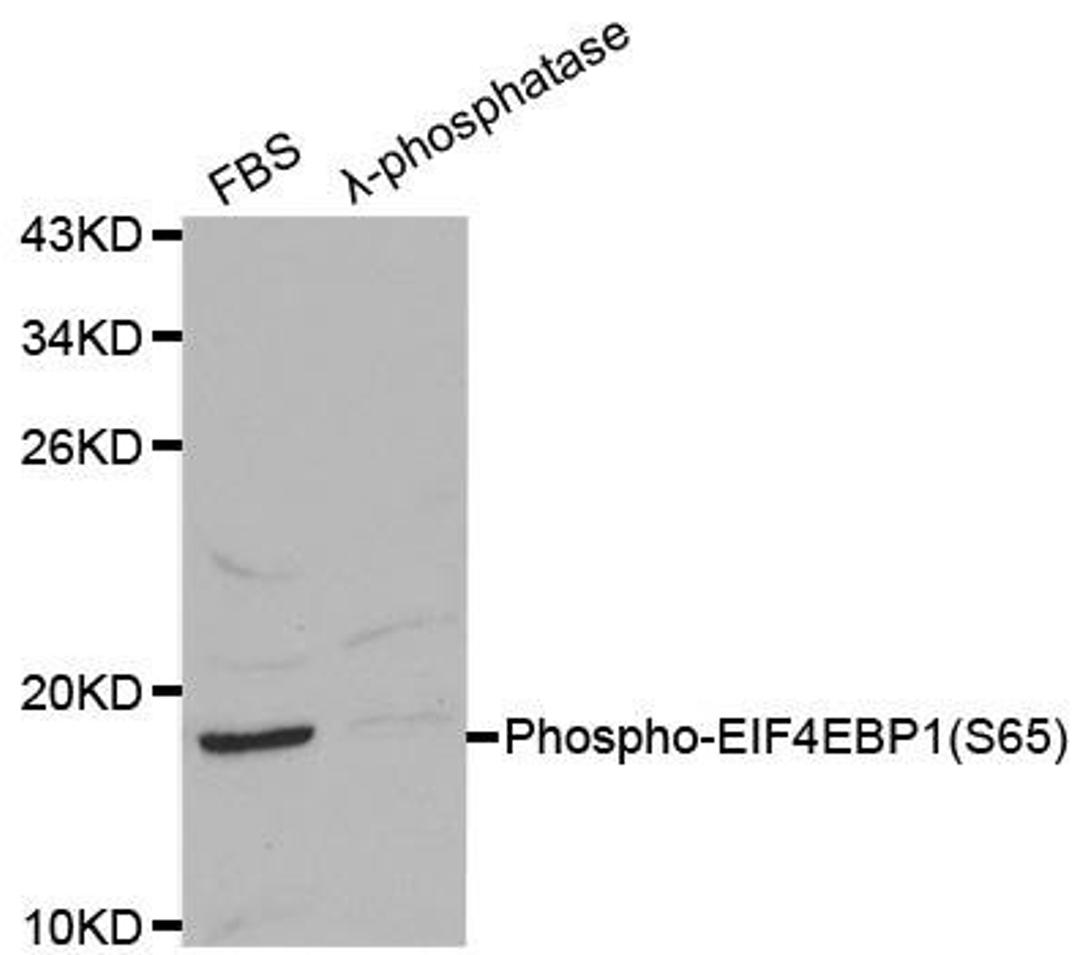 Western blot analysis on 293 cell lysates using EIF4EBP1 (phospho-Ser65) antibody