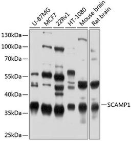 Western blot - SCAMP1 antibody (A9092)