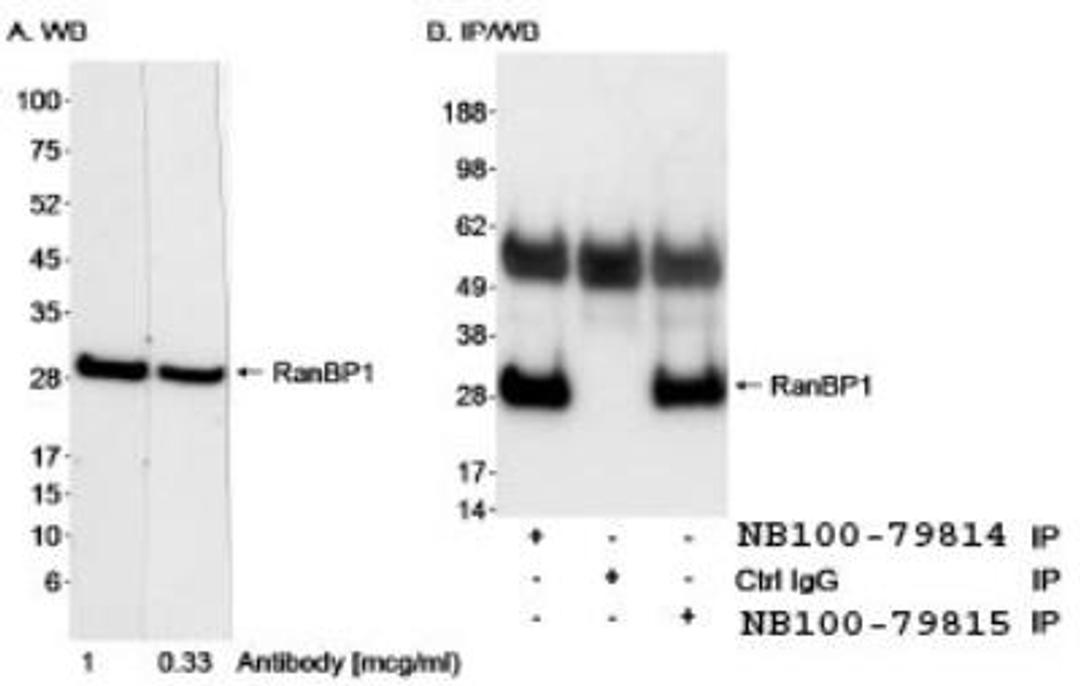 Western Blot: RanBP1 Antibody [NB100-79814] - Detection of Human RanBP1 on HeLa whole cell lysate using NB100-79814. RanBP1 was also immunoprecipitated using rabbit anti-RanBP1 antibody BL1968 NB100-79815 at 5 mcg/0.5 mg lysate.