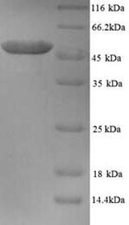 (Tris-Glycine gel) Discontinuous SDS-PAGE (reduced) with 5% enrichment gel and 15% separation gel.