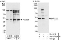 Detection of human PDCD2L by western blot and immunoprecipitation.