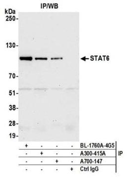 Detection of human STAT6 by western blot of immunoprecipitates.