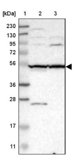 Western Blot: SLC35F1 Antibody [NBP1-86755] - Lane 1: Marker [kDa] 230, 130, 95, 72, 56, 36, 28, 17, 11<br/>Lane 2: Human cell line RT-4<br/>Lane 3: Human cell line U-251MG sp