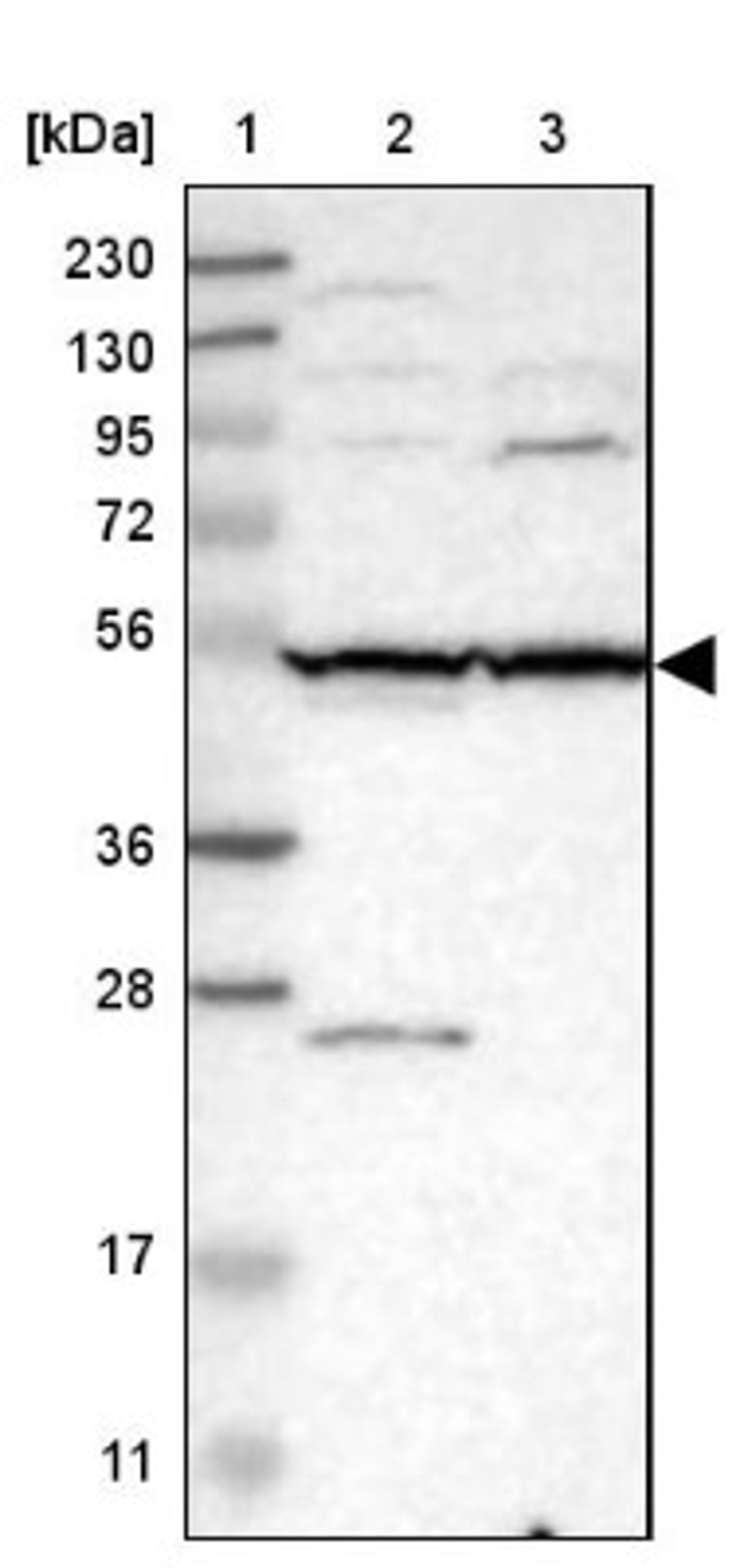 Western Blot: SLC35F1 Antibody [NBP1-86755] - Lane 1: Marker [kDa] 230, 130, 95, 72, 56, 36, 28, 17, 11<br/>Lane 2: Human cell line RT-4<br/>Lane 3: Human cell line U-251MG sp