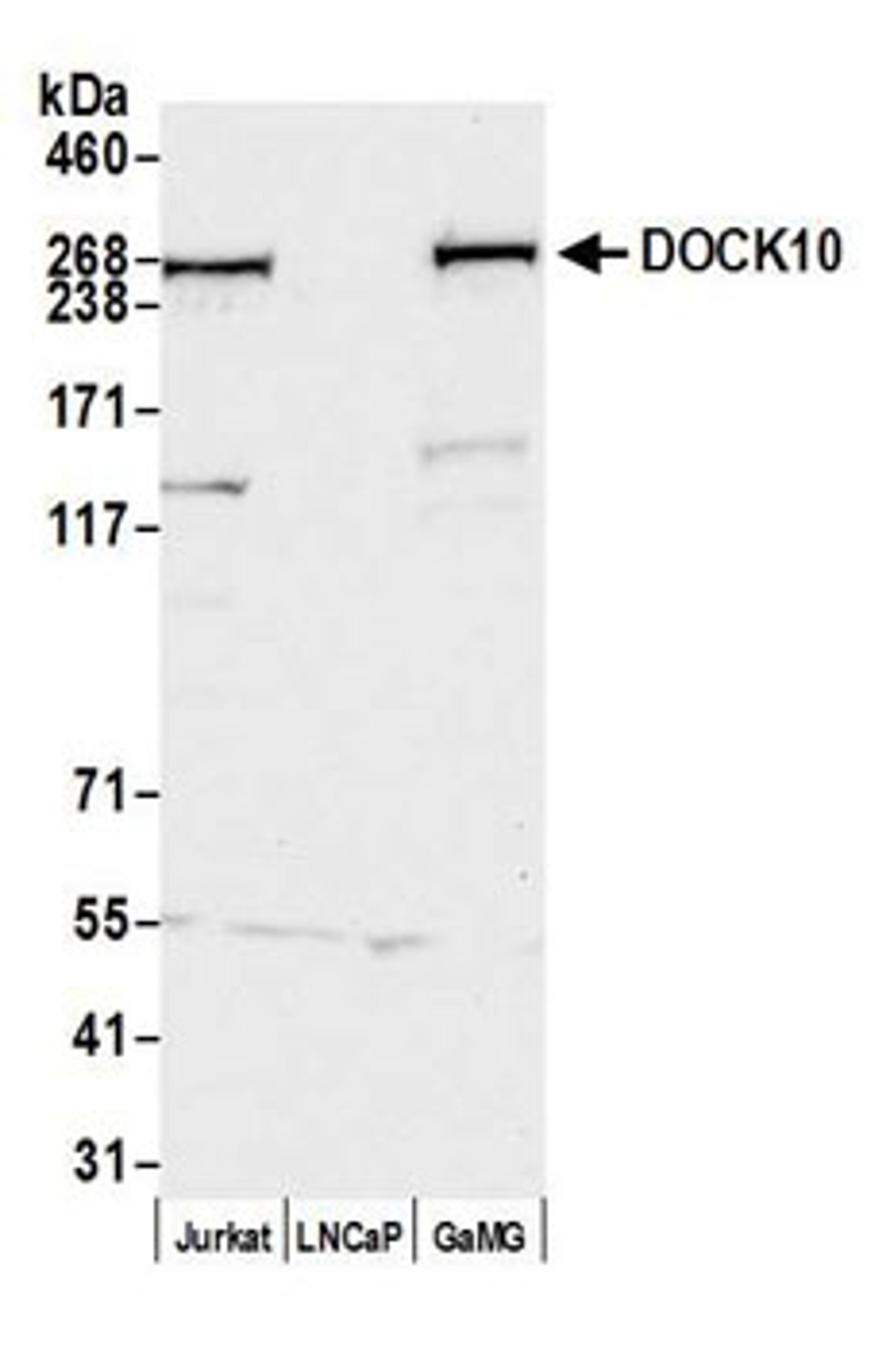 Detection of human DOCK10 by western blot.