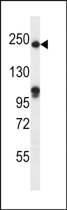 Western blot analysis in mouse heart tissue lysates (35ug/lane).