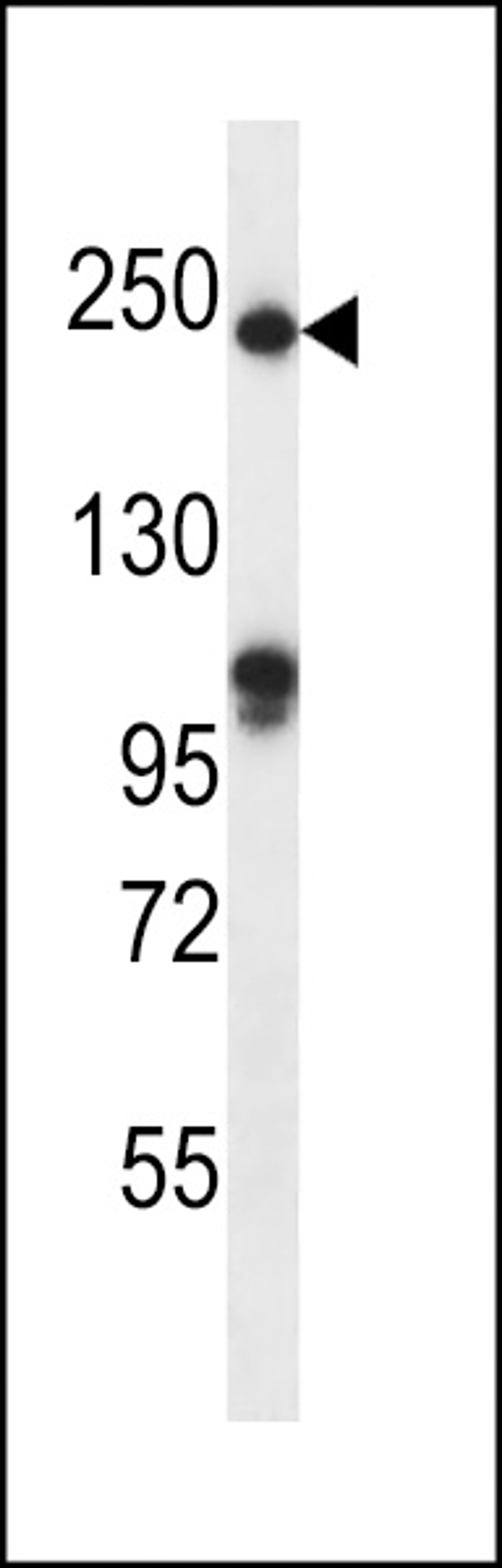 Western blot analysis in mouse heart tissue lysates (35ug/lane).