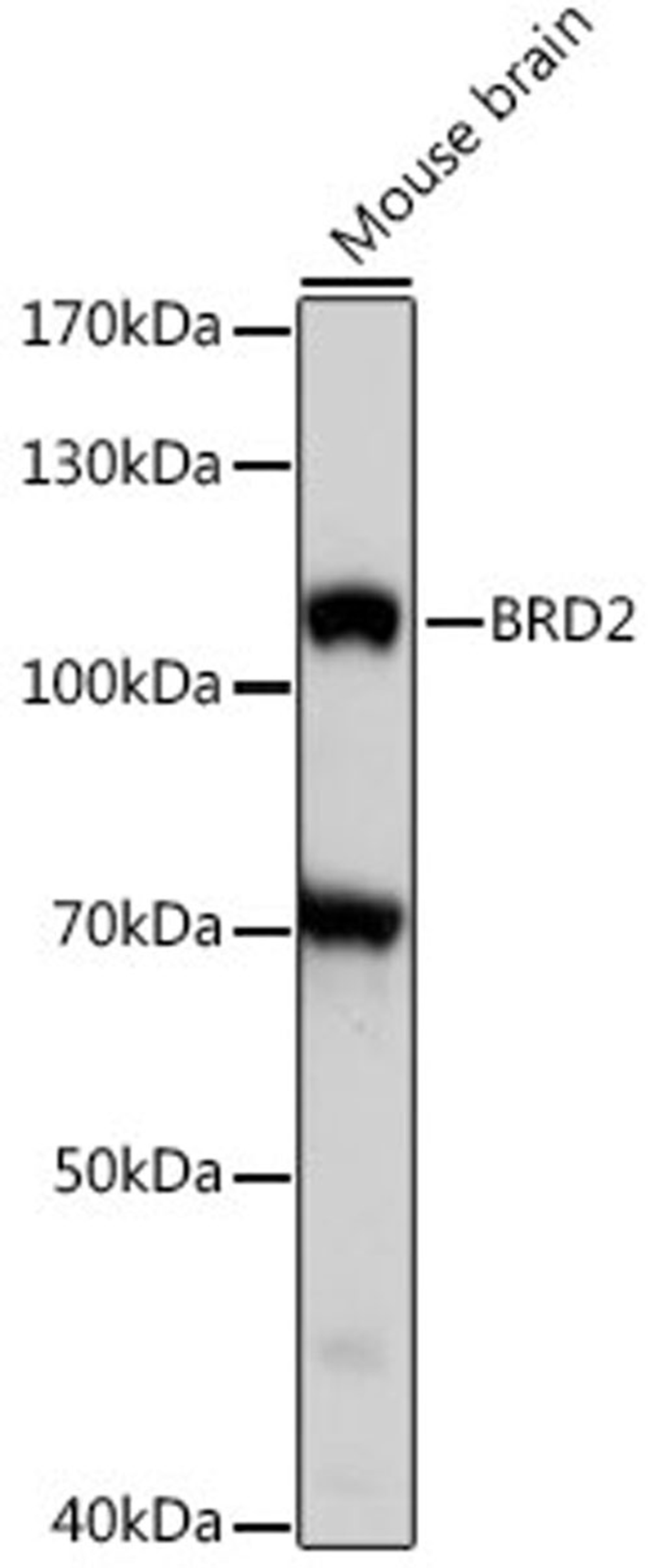 Western blot - BRD2 antibody (A16241)