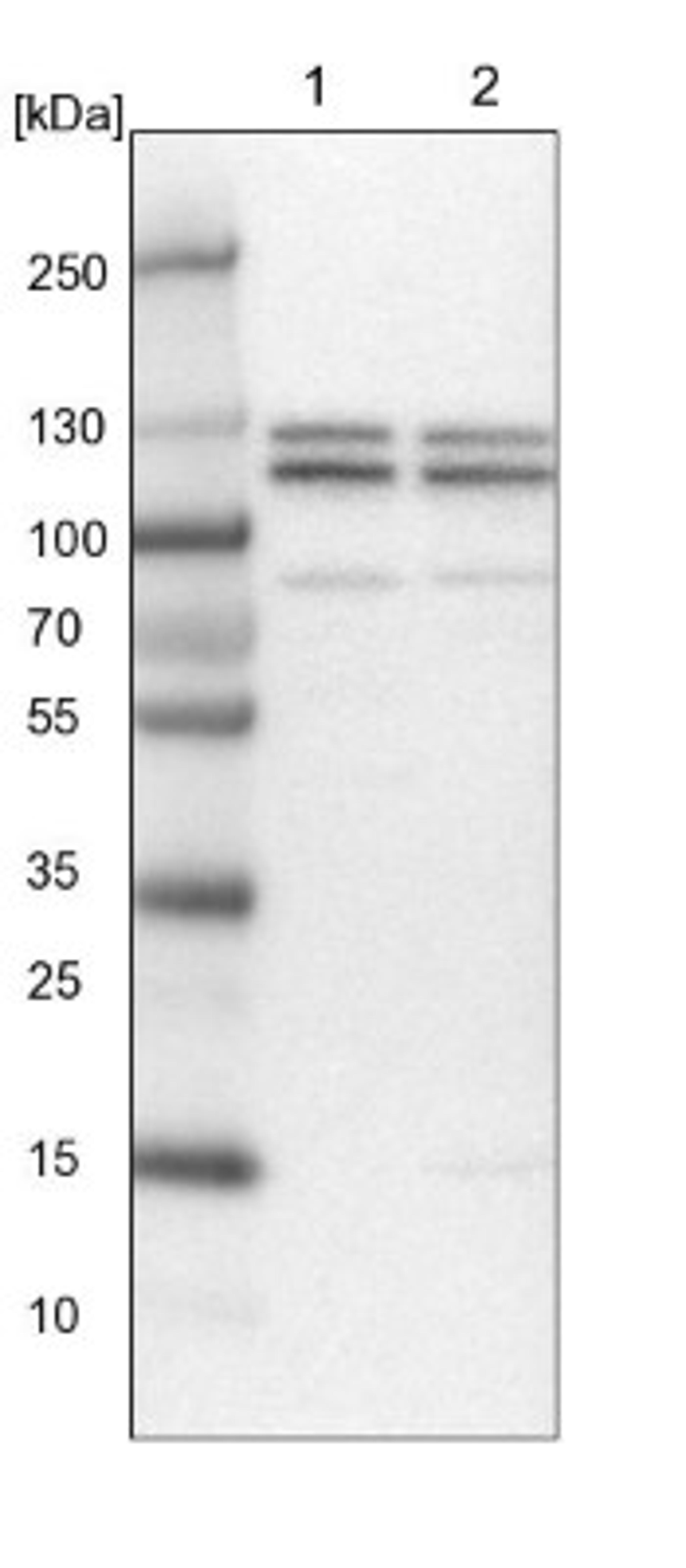 Western Blot: RBM10 Antibody [NBP1-84951] - Lane 1: NIH-3T3 cell lysate (Mouse embryonic fibroblast cells)<br/>Lane 2: NBT-II cell lysate (Rat Wistar bladder tumour cells)