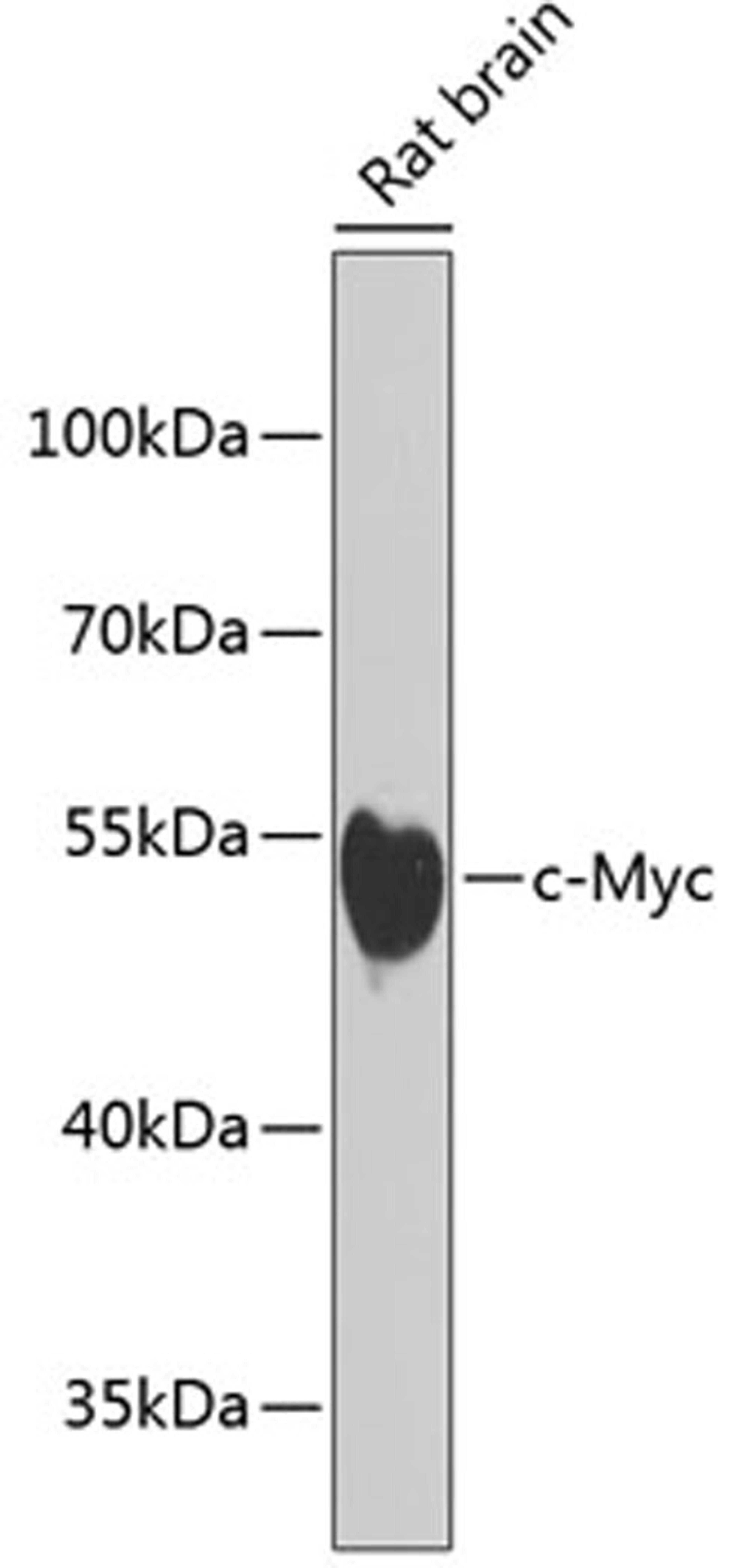 Western blot - c-Myc antibody (A1309)