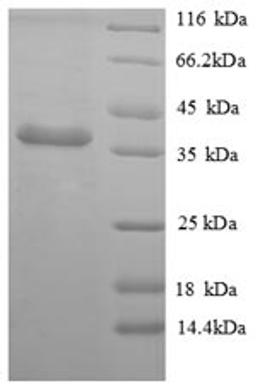 (Tris-Glycine gel) Discontinuous SDS-PAGE (reduced) with 5% enrichment gel and 15% separation gel.