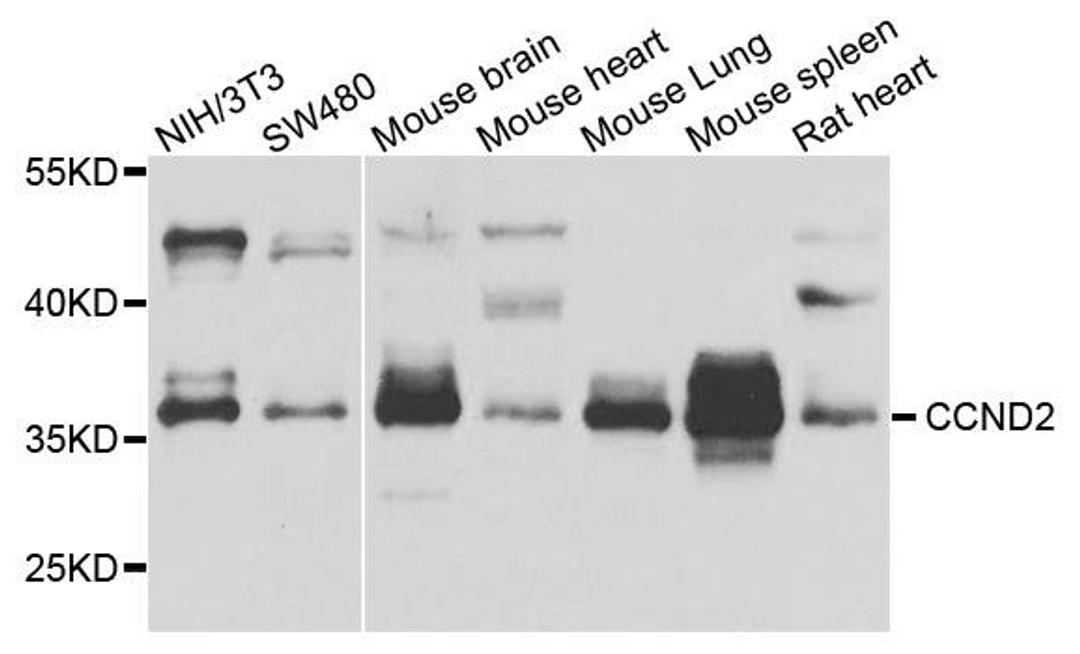 Western blot analysis of extract of various cells using CCND2 antibody