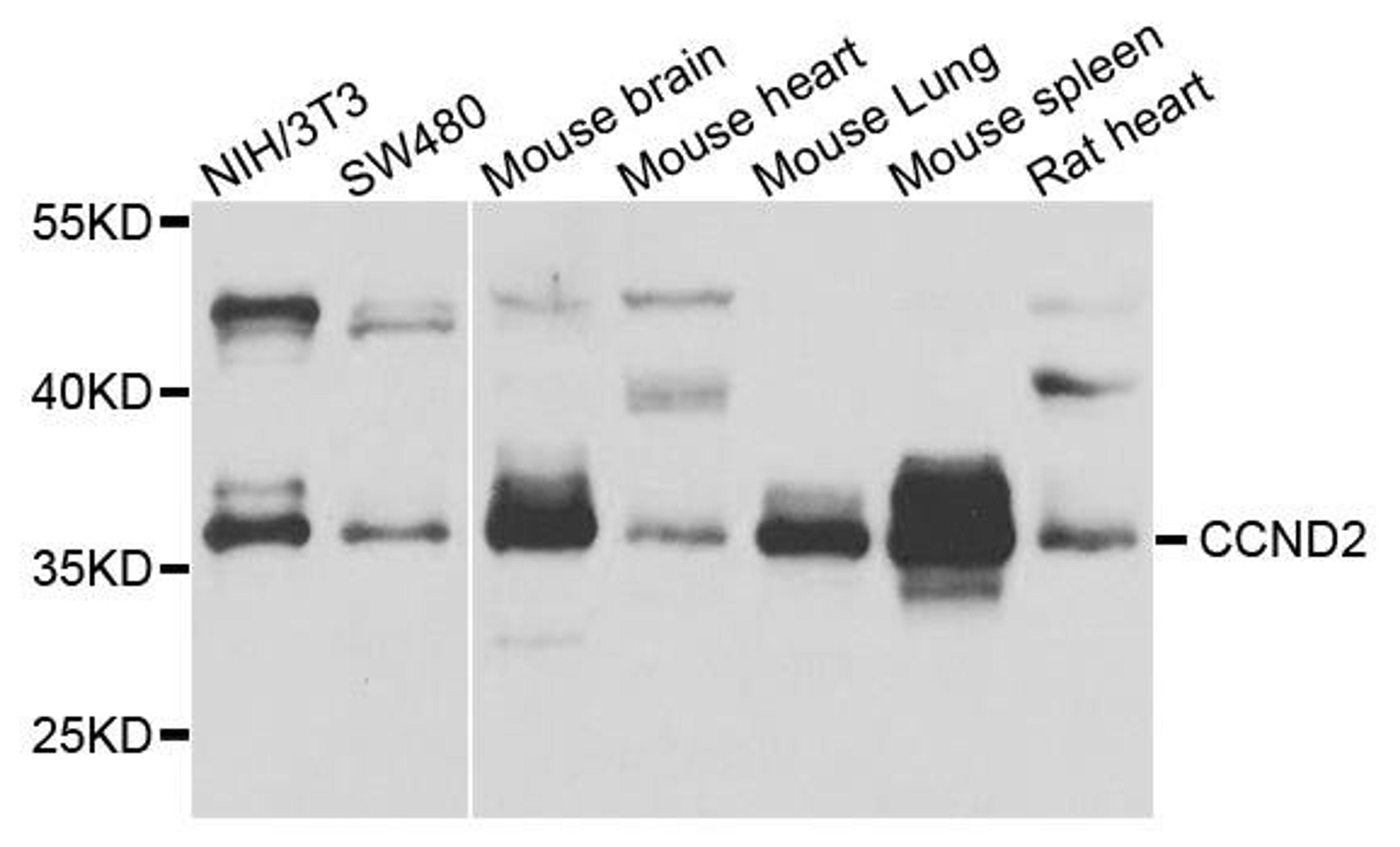 Western blot analysis of extract of various cells using CCND2 antibody