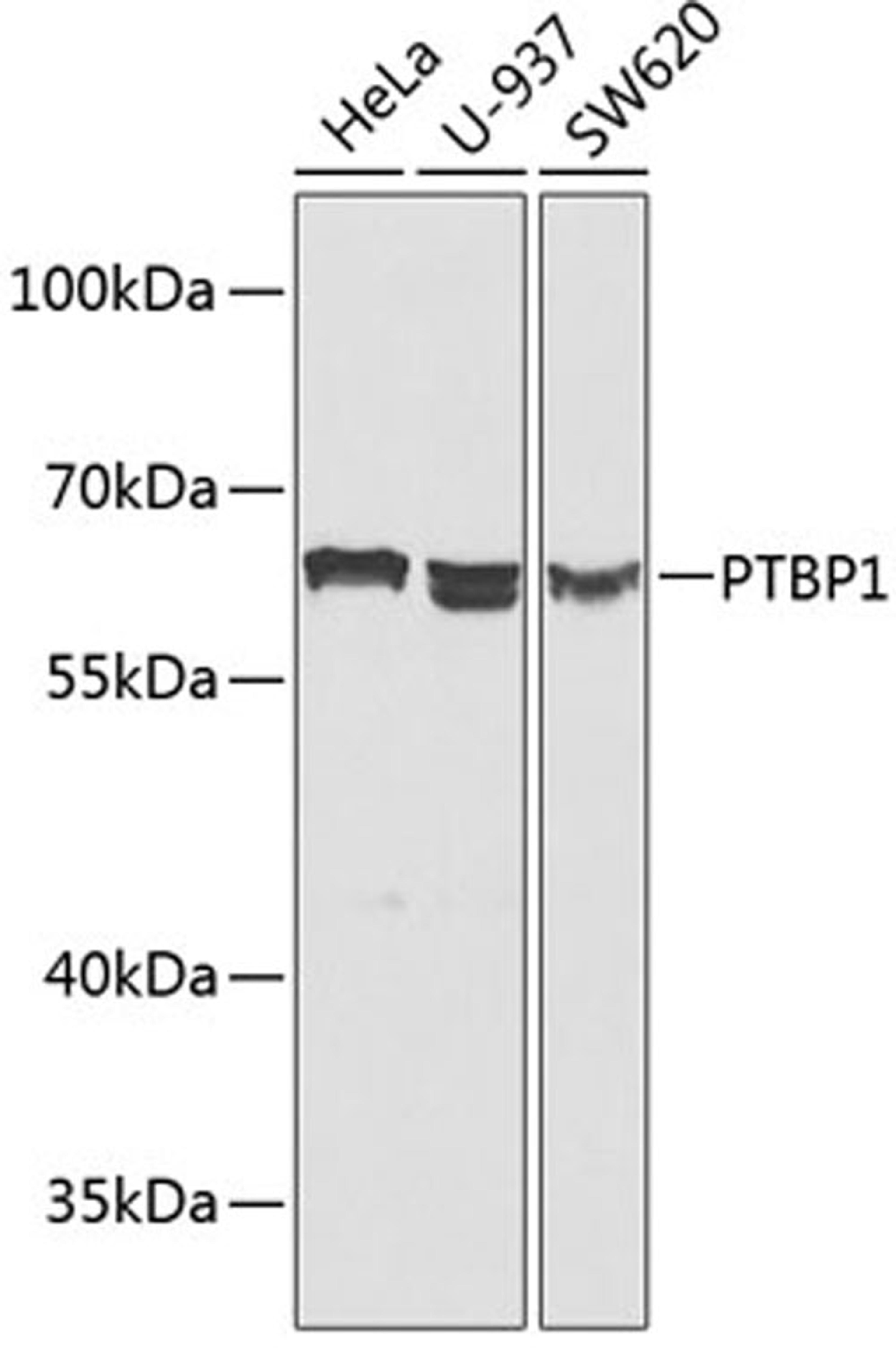 Western blot - PTBP1 antibody (A1831)