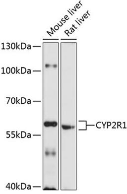 Western blot - CYP2R1 antibody (A10470)