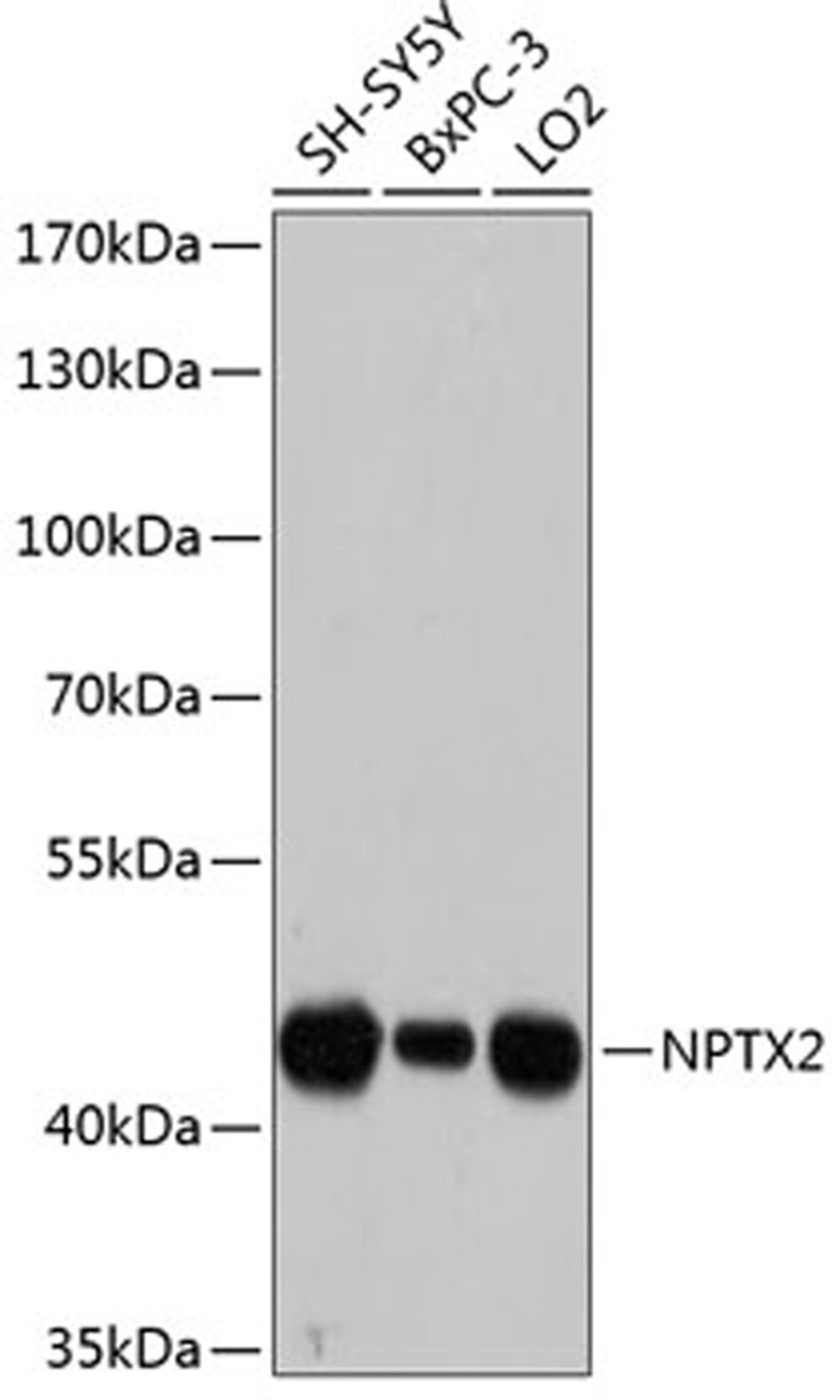 Western blot - NPTX2 antibody (A12031)