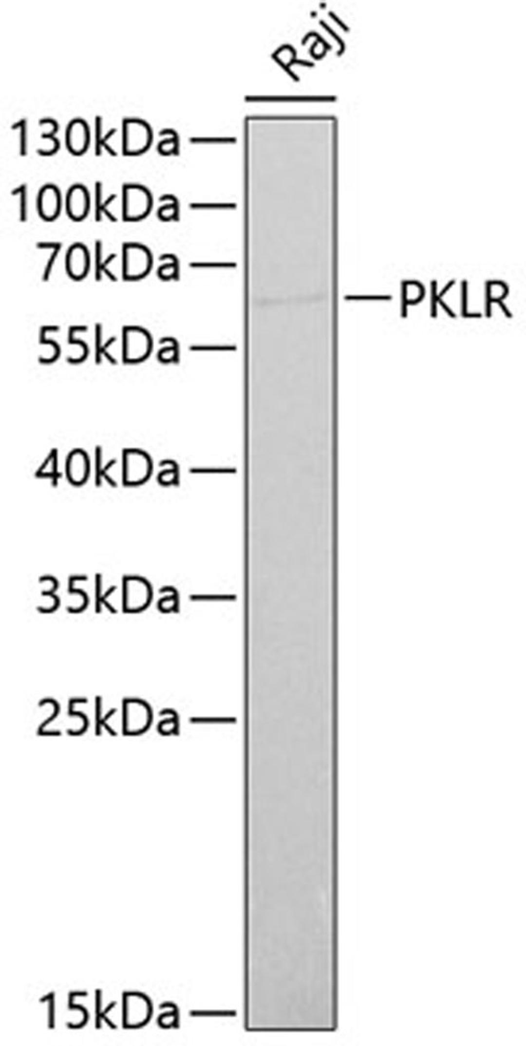 Western blot - PKLR antibody (A1924)