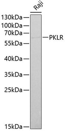 Western blot - PKLR antibody (A1924)