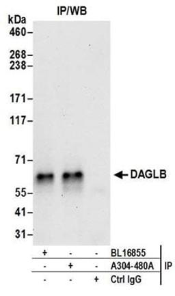 Detection of human DAGLB by western blot of immunoprecipitates.