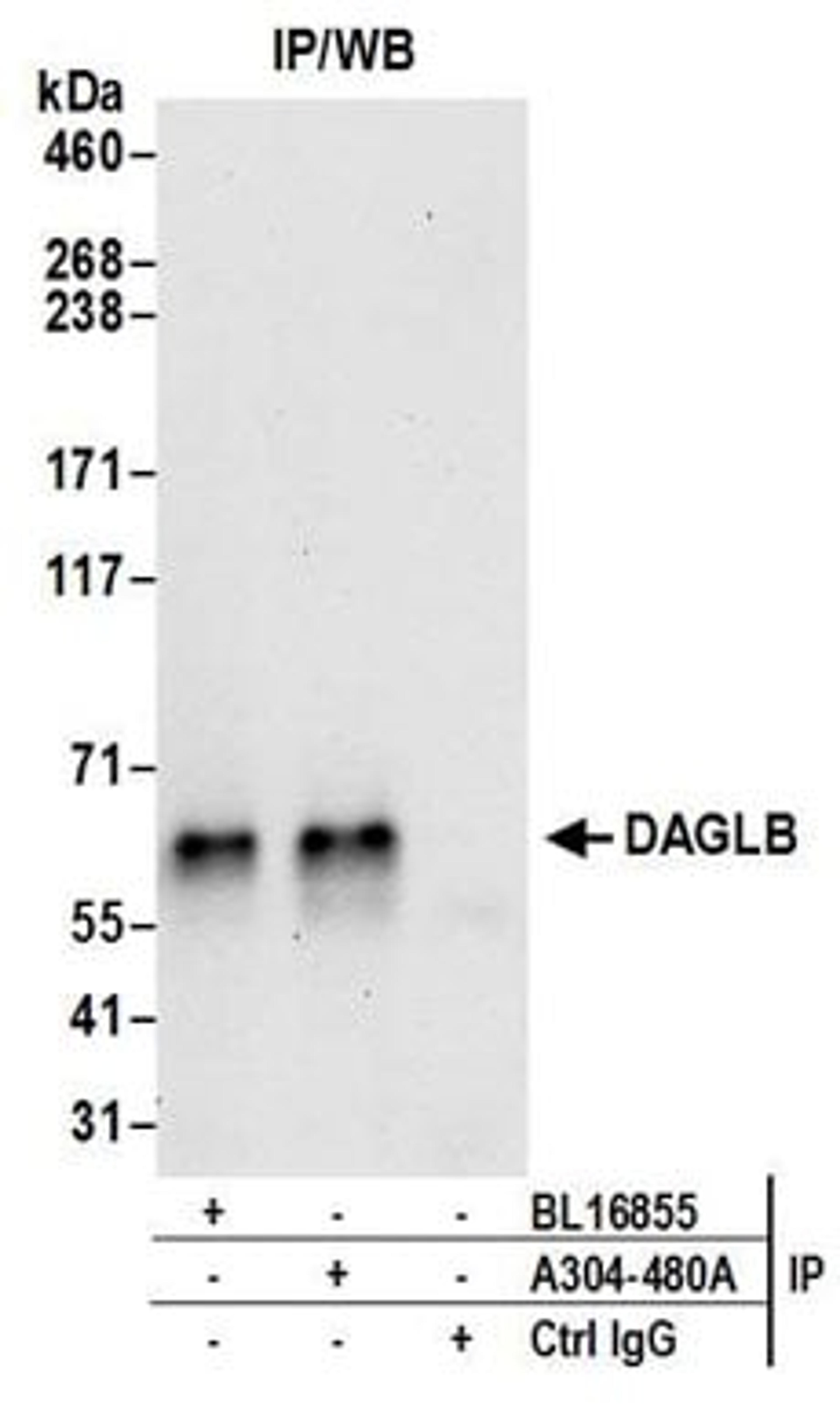 Detection of human DAGLB by western blot of immunoprecipitates.