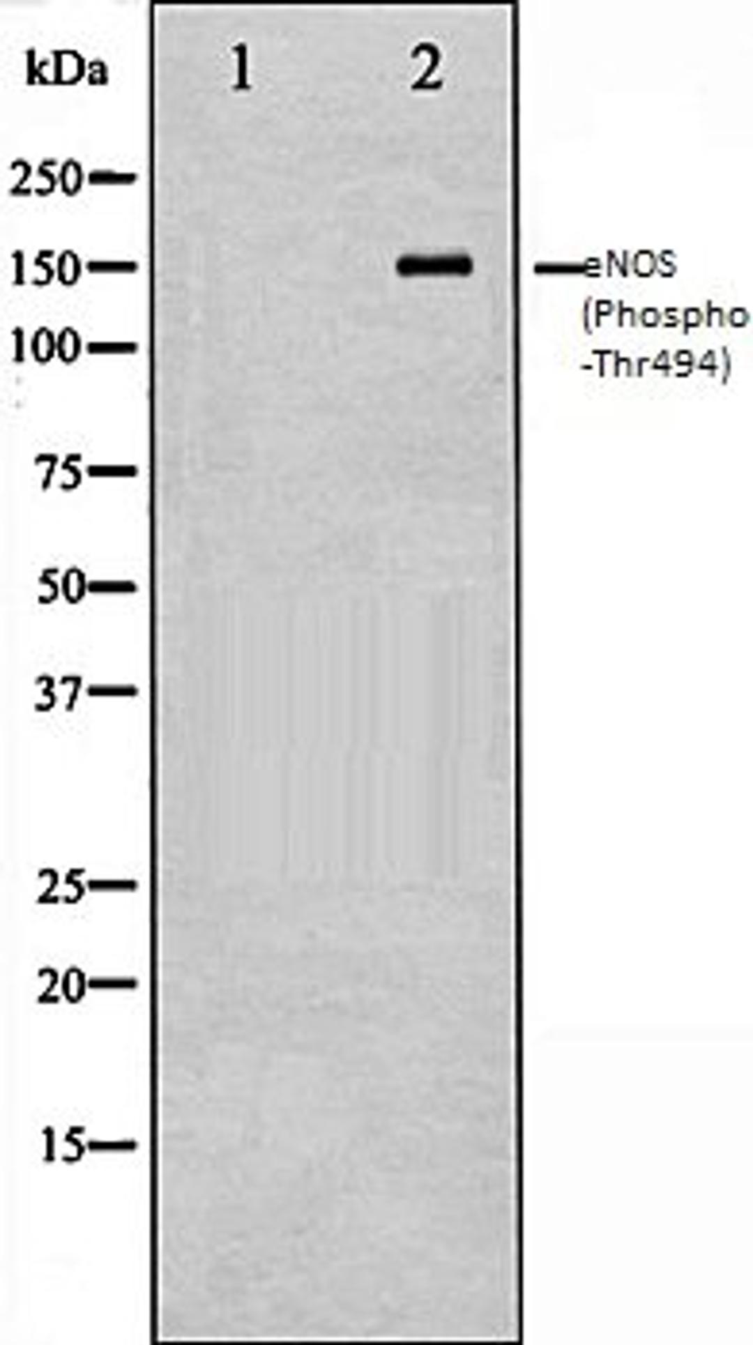 Western blot analysis of HepG2 whole cell lysates using eNOS (Phospho-Thr494) antibody, The lane on the left is treated with the antigen-specific peptide.