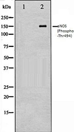 Western blot analysis of HepG2 whole cell lysates using eNOS (Phospho-Thr494) antibody, The lane on the left is treated with the antigen-specific peptide.