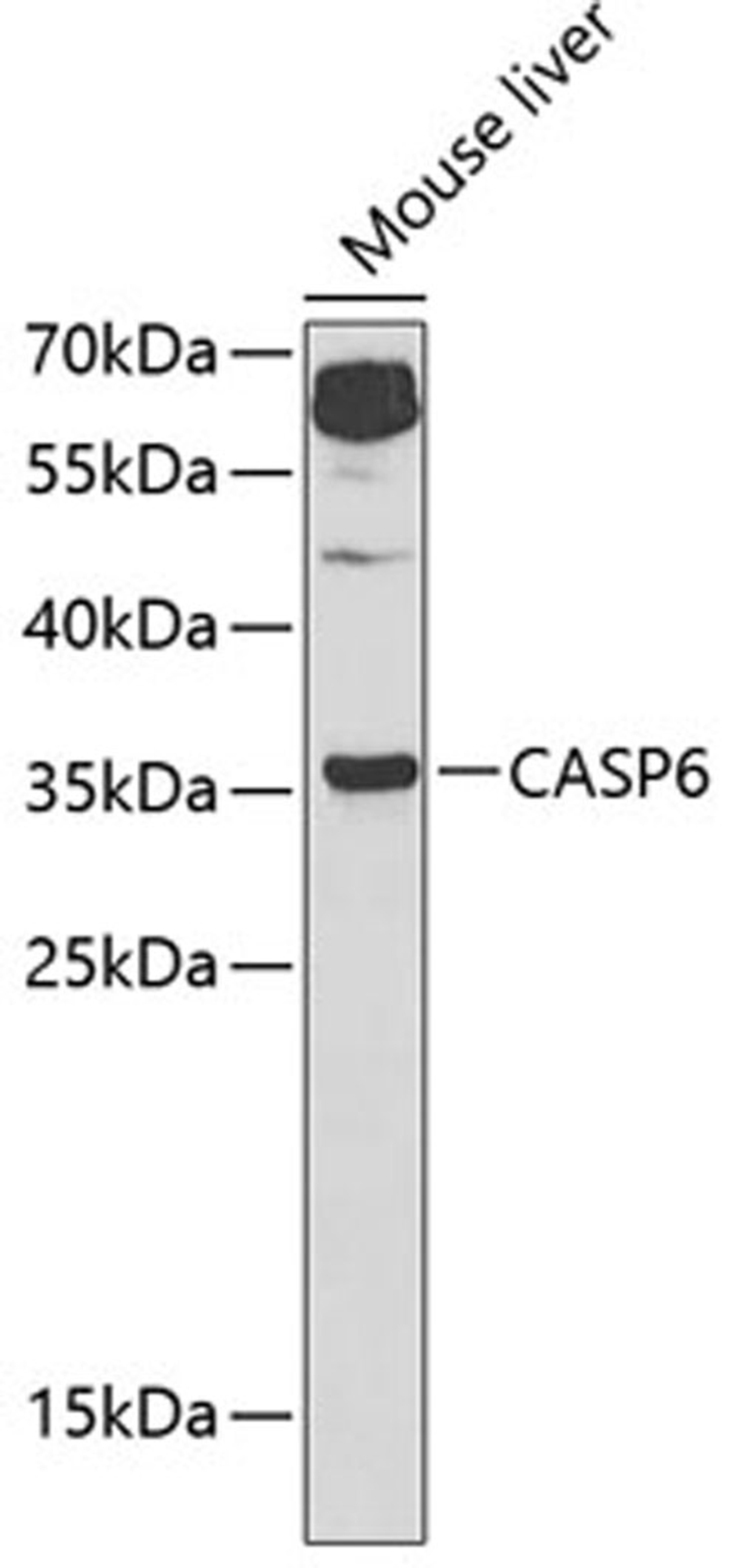 Western blot - Caspase-6 Antibody (A1784)