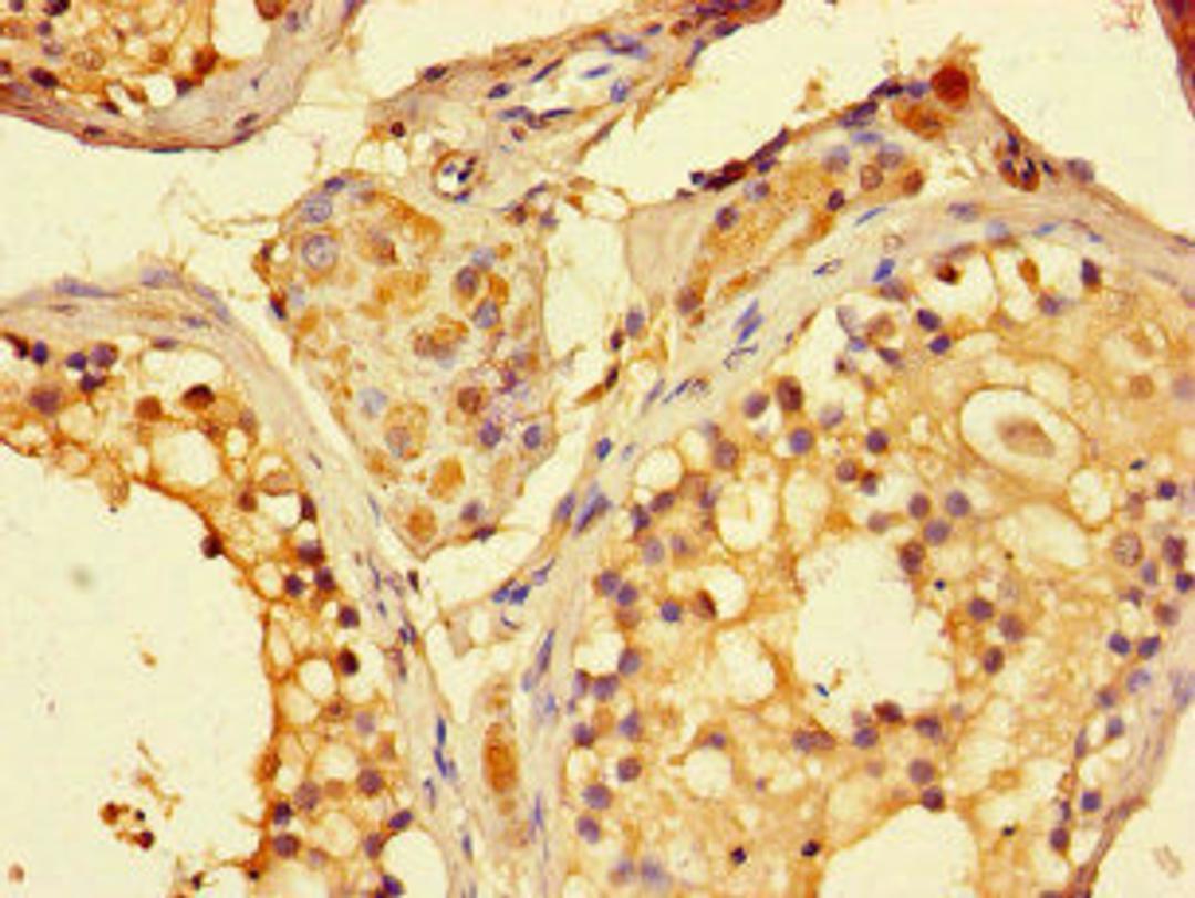 Immunohistochemistry of paraffin-embedded human testis tissue using CSB-PA822202HA01HU at dilution of 1:100