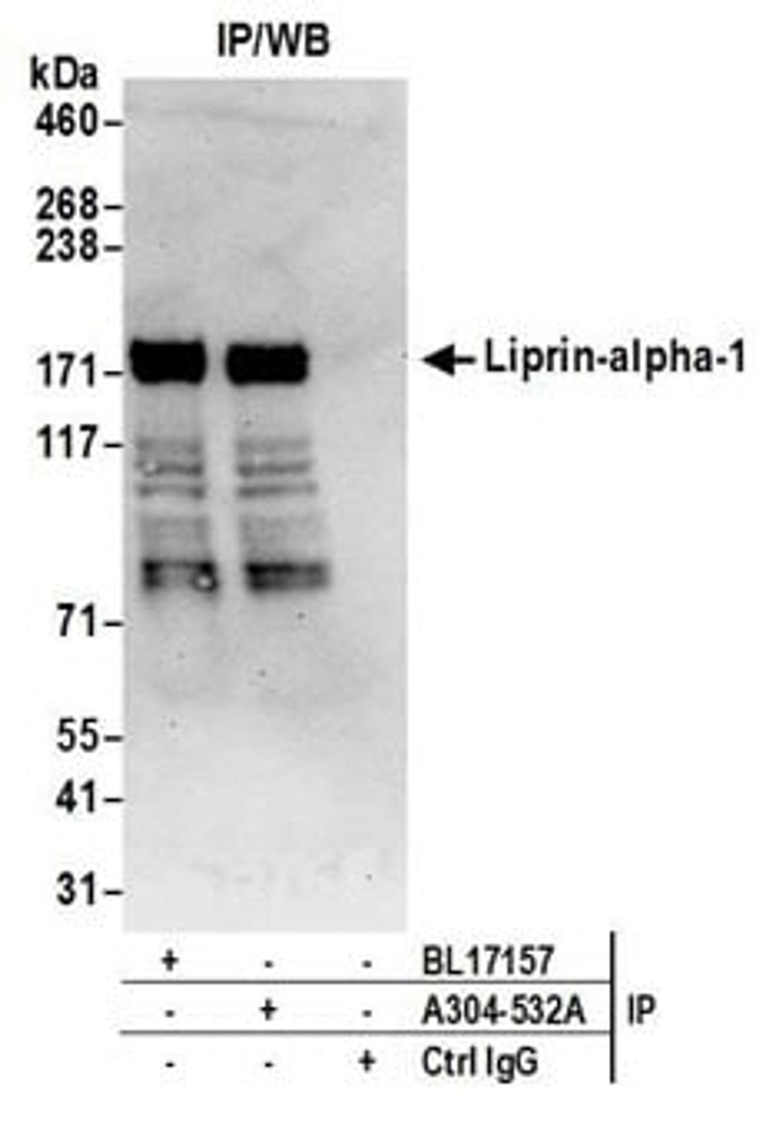 Detection of human Liprin-alpha-1 by western blot of immunoprecipitates.