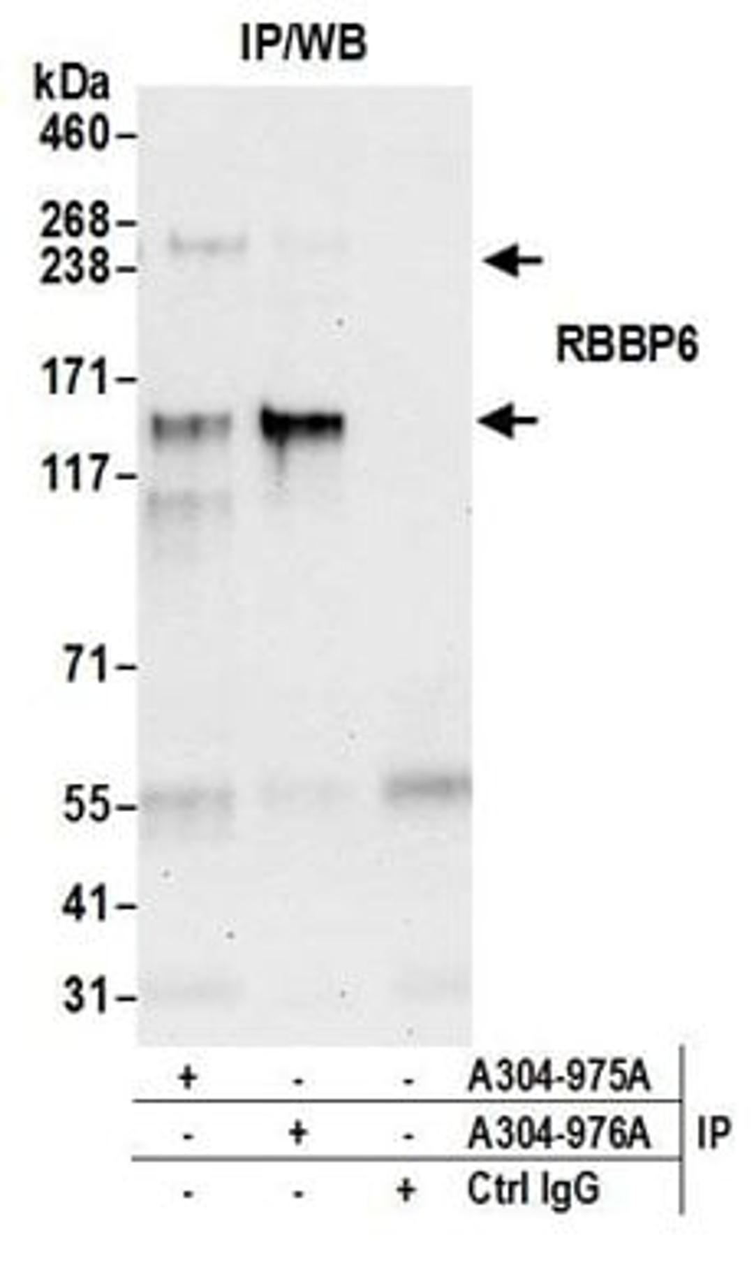 Detection of human RBBP6 by western blot of immunoprecipitates.