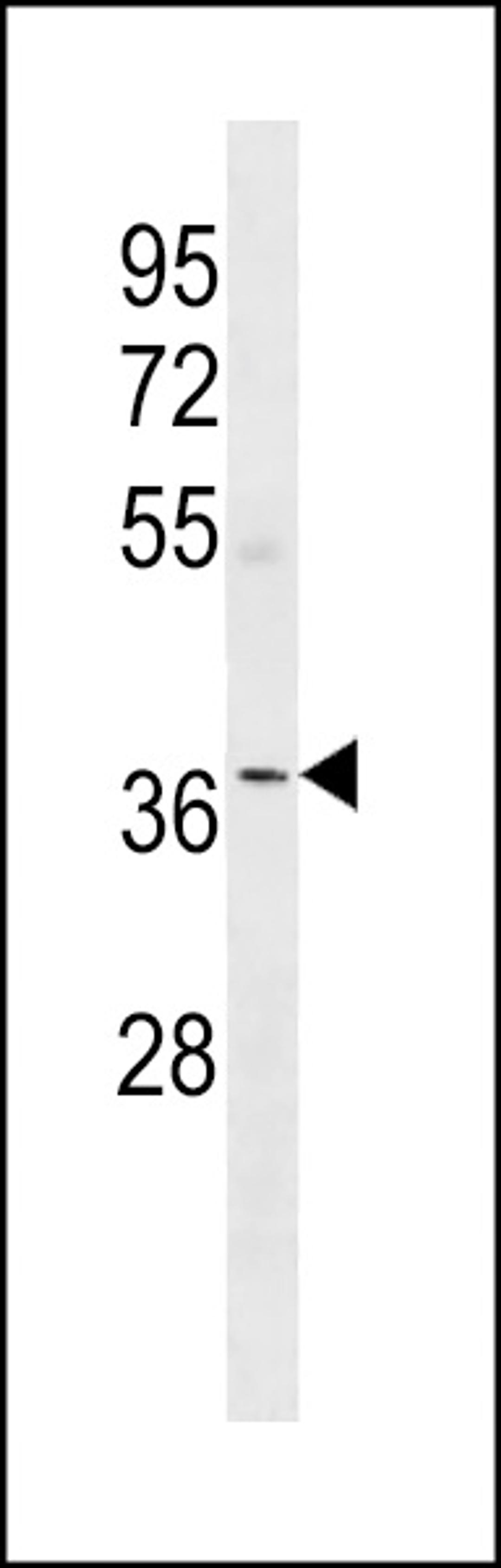 Western blot analysis in human Uterus tissue lysates (35ug/lane).