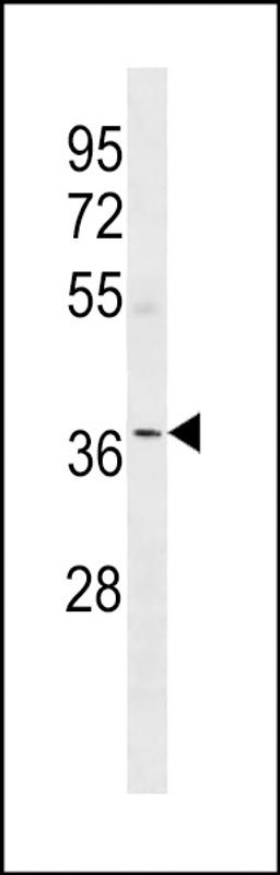 Western blot analysis in human Uterus tissue lysates (35ug/lane).