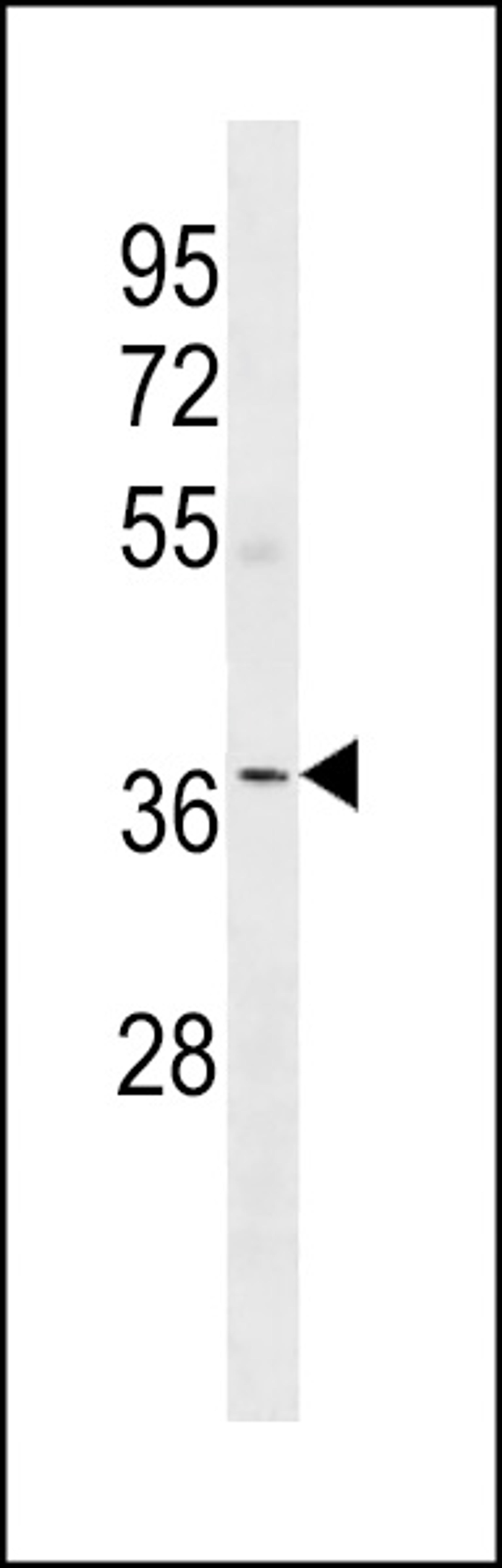 Western blot analysis in human Uterus tissue lysates (35ug/lane).