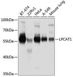 Western blot - LPCAT1 antibody (A4987)