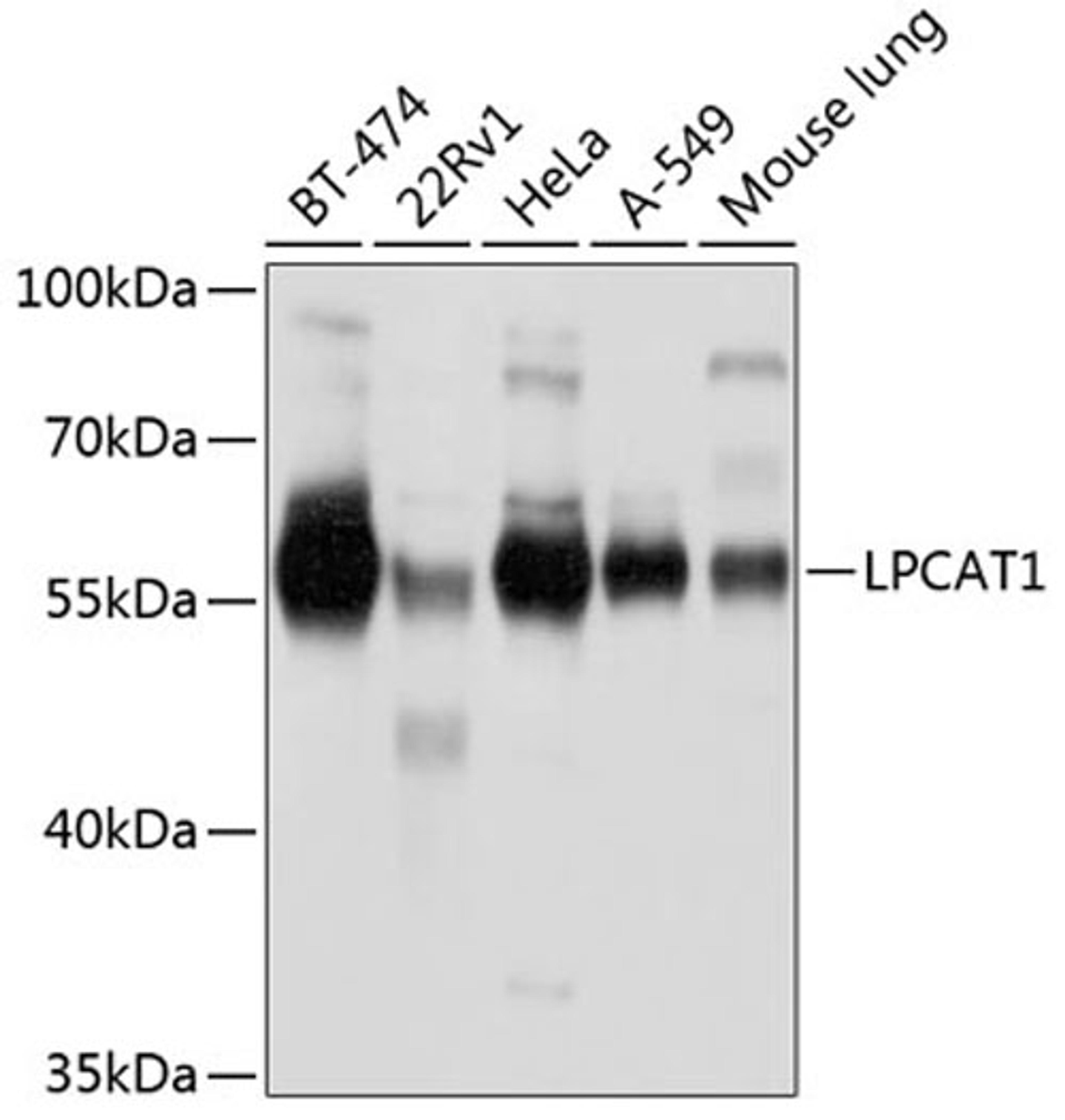 Western blot - LPCAT1 antibody (A4987)