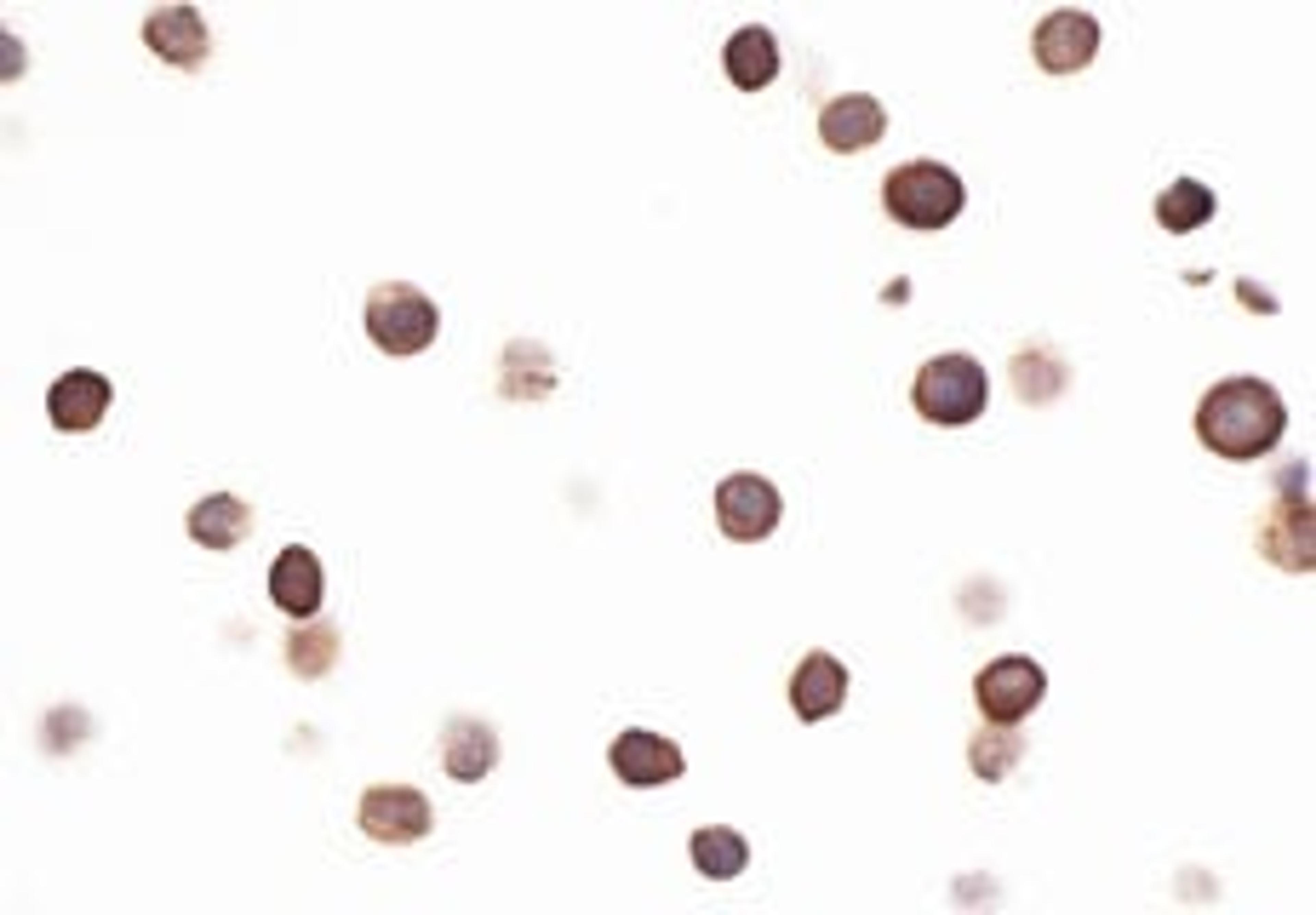 Detection of human CD96 by immunocytochemistry.