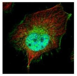 Immunocytochemistry/Immunofluorescence: SMYD3 Antibody [NBP2-20430] - Confocal immunofluorescence analysis of paraformaldehyde-fixed HeLa, using SMYD3 antibody (Green) at 1:500 dilution. Alpha-tubulin filaments are labeled with Alpha-tubulin antibody (Red) at 1:2000.