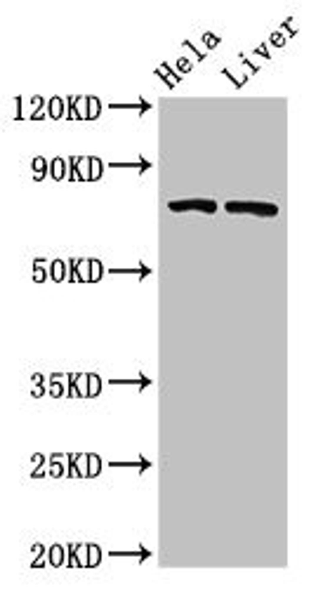 Western Blot. Positive WB detected in: Hela whole cell lysate, Rat liver tissue. All lanes: ACSL5 antibody at 3µg/ml. Secondary. Goat polyclonal to rabbit IgG at 1/50000 dilution. Predicted band size: 76, 83, 74, kDa. Observed band size: 76 kDa