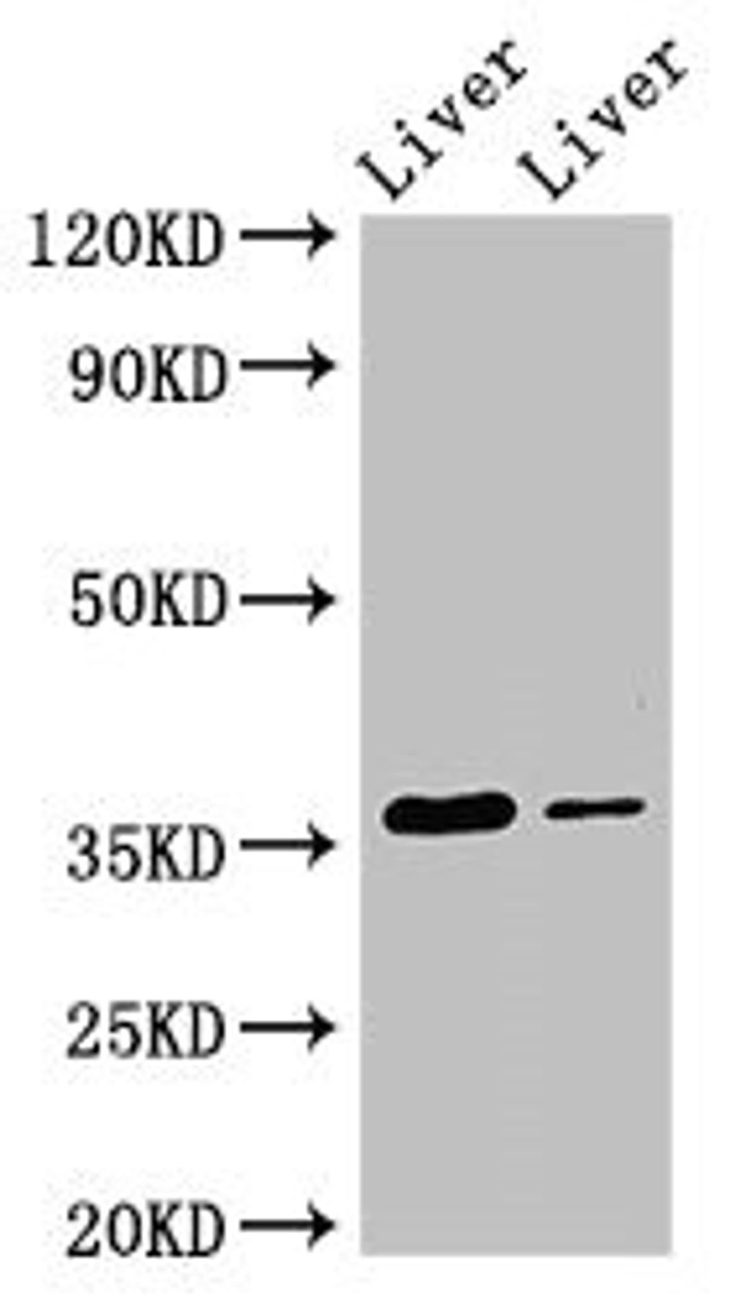 Western Blot. Positive WB detected in: Rat liver tissue, Mouse liver tissue. All lanes: GRHPR antibody at 3.5ug/ml. Secondary. Goat polyclonal to rabbit IgG at 1/50000 dilution. Predicted band size: 36, 28 kDa. Observed band size: 36 kDa. 