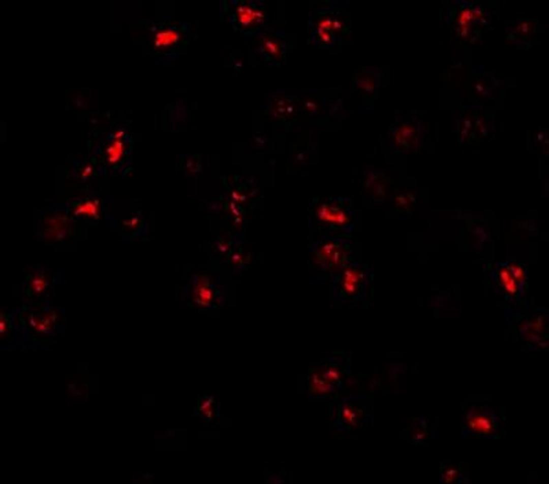 Immunocytochemistry/Immunofluorescence: ATAD3A Antibody [NBP1-76586] - Immunofluorescence of ATAD3A in Daudi cells with ATAD3A antibody at 20 ug/mL.