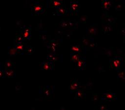 Immunocytochemistry/Immunofluorescence: ATAD3A Antibody [NBP1-76586] - Immunofluorescence of ATAD3A in Daudi cells with ATAD3A antibody at 20 ug/mL.